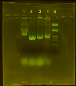 Electroforesis en gel de agarosa