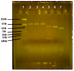 Electroforesis de digestiones en gel de agarosa